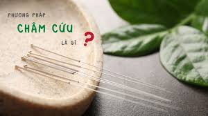 Dịch vụ châm cứu